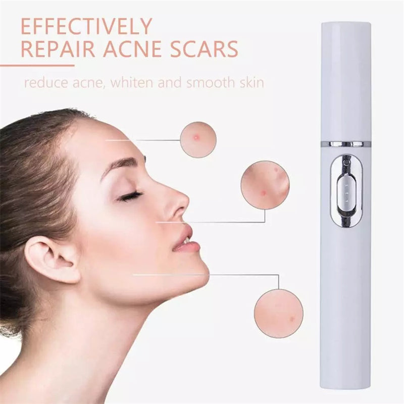 Blue Light Therapy Acne Laser Pen